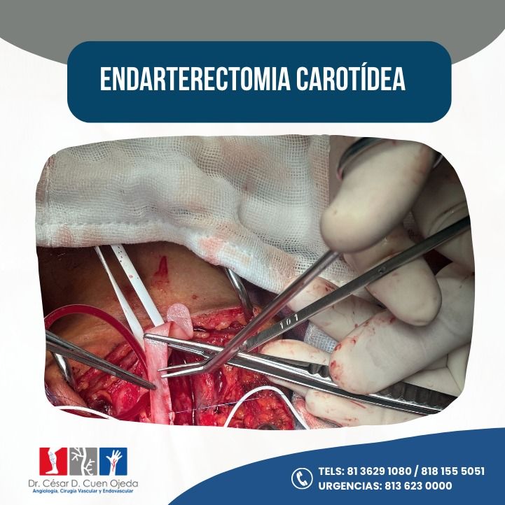 César Daniel Cuen Ojeda-13