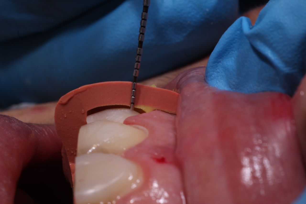 Fredy Alejandro Roblero Gónzalez-61