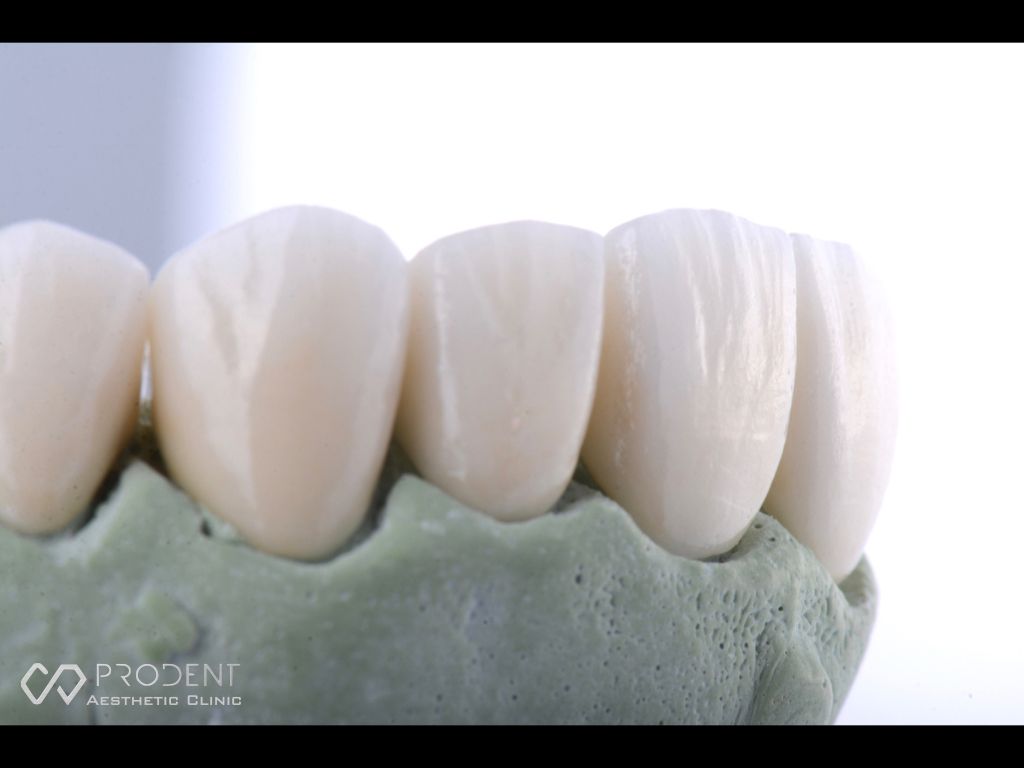 Ramiro Ivan Pérez Murillo-46