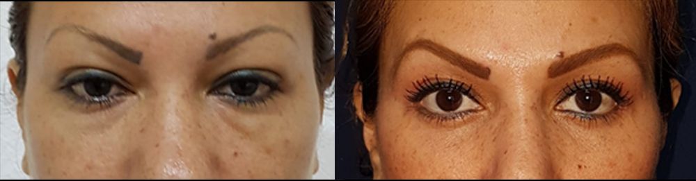 Edgar Ernesto Torres Mejía-21