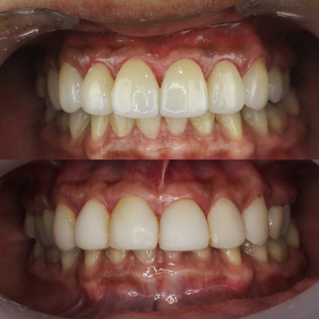 Alejandro Bates Souza-5