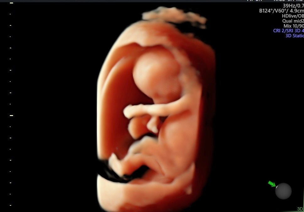 Martín Francisco Pérez Peña-6