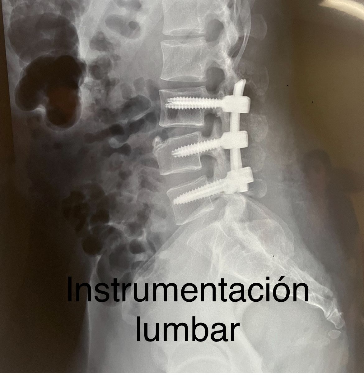 Emmanuel Bolaños Cortes-5