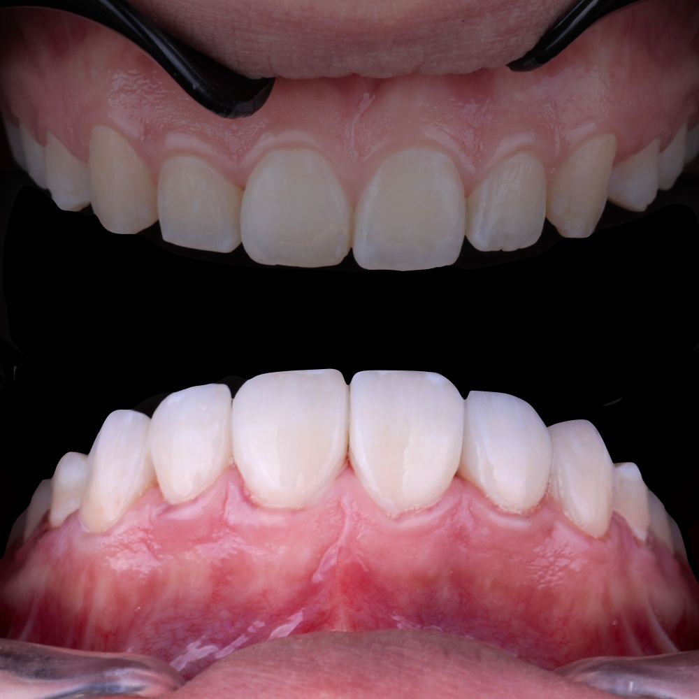 Itzel Abigail Montiel Garces-4