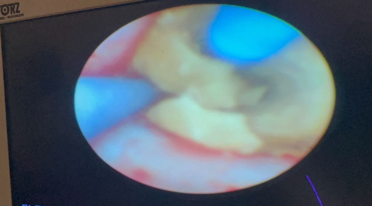 Marco Antonio Sillas Martínez-17