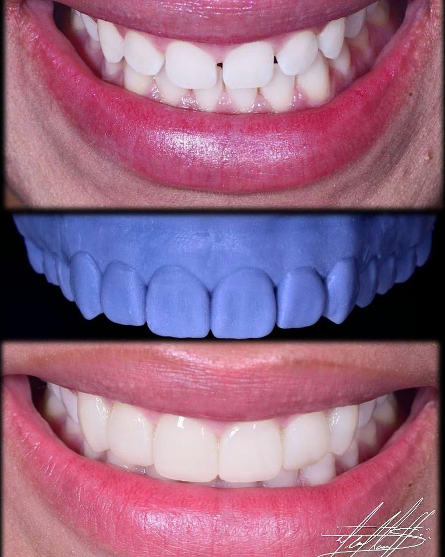 Blanca Elvia Soto Canales-7