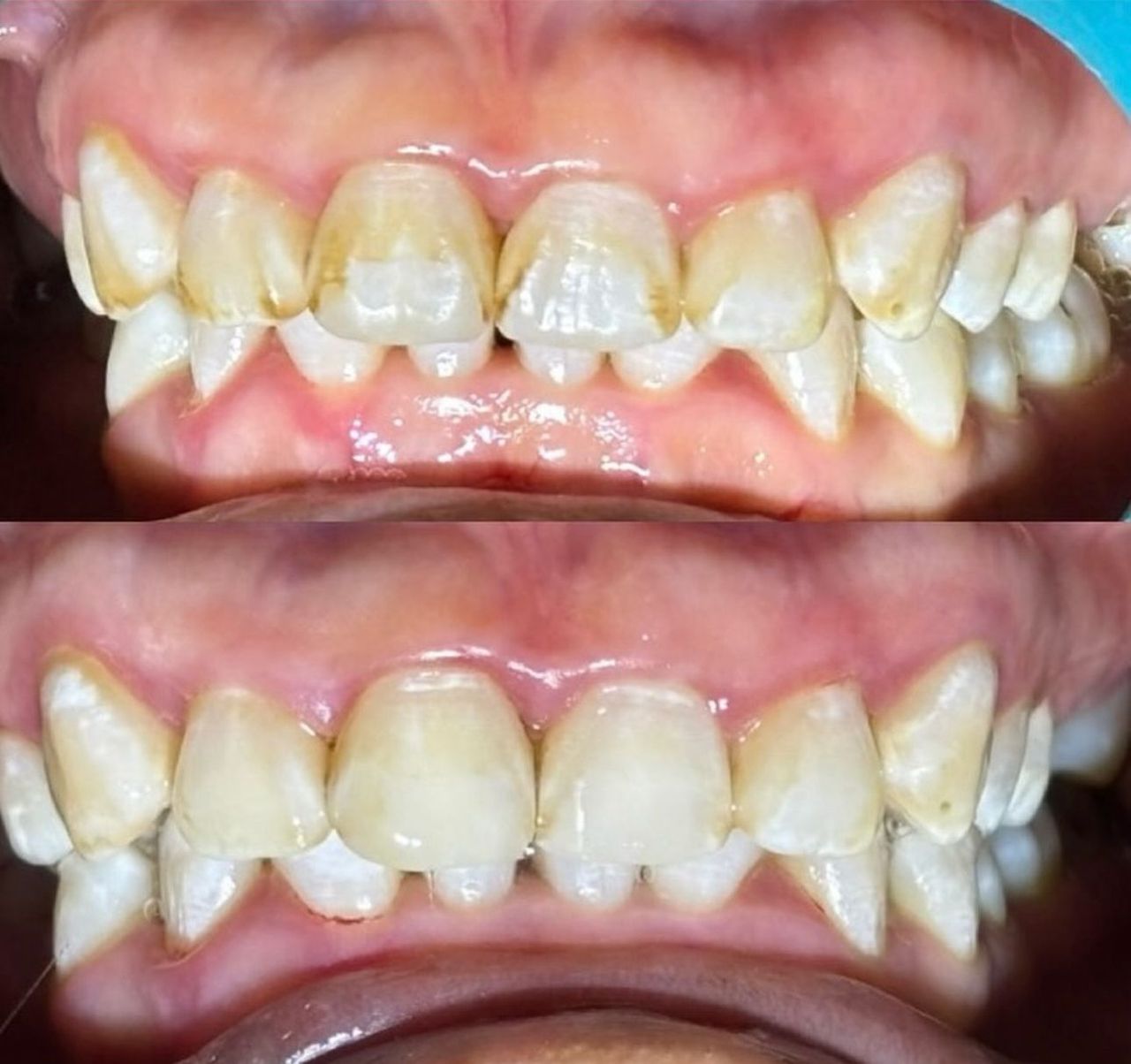 Luis Arturo Baca Niño De Rivera-14