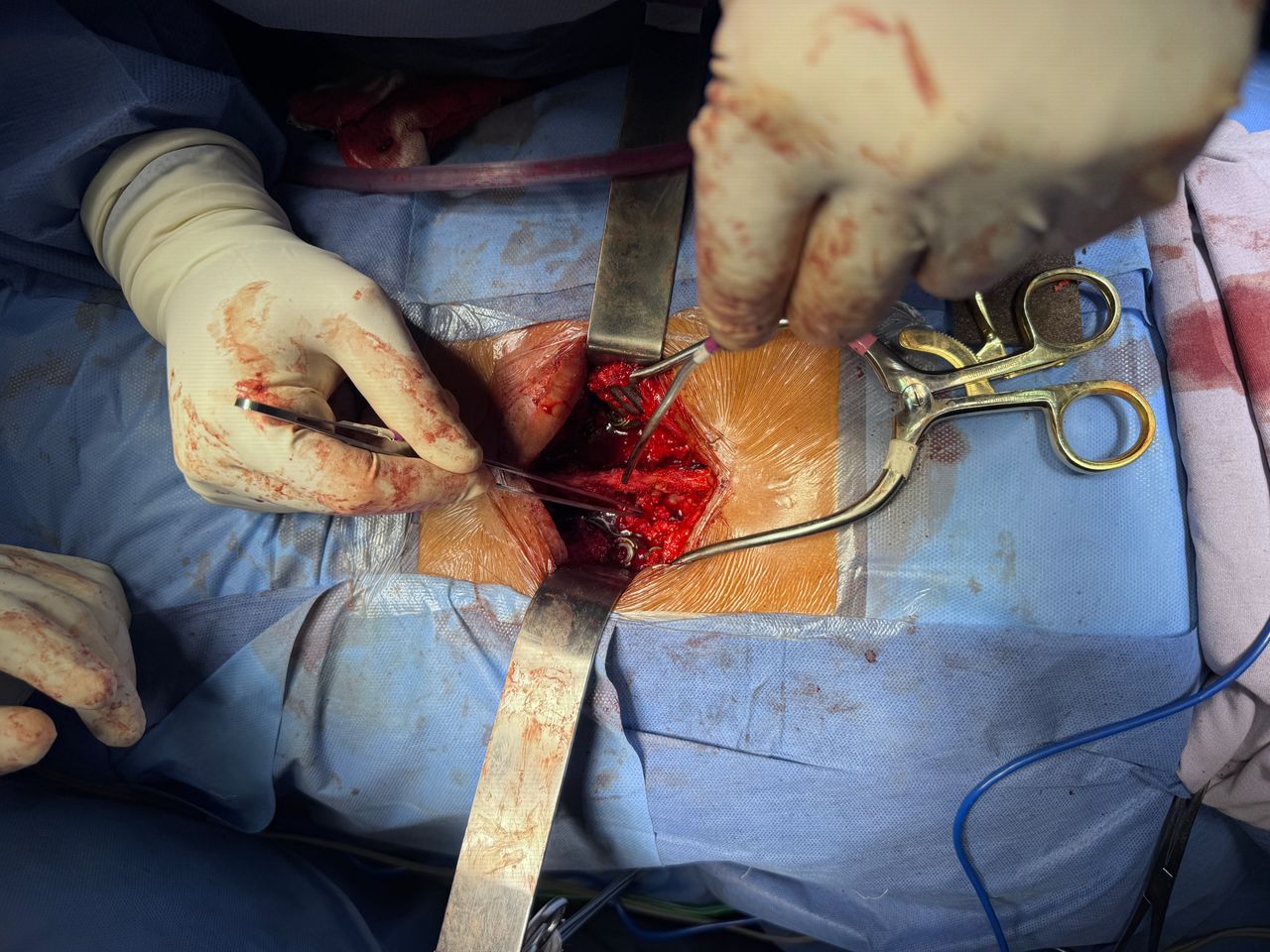 Samuel Carlos Herrera Avila-5