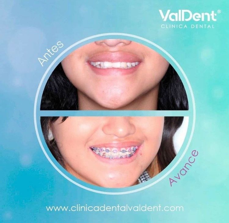 Karla Valdespino Gutierrez-11