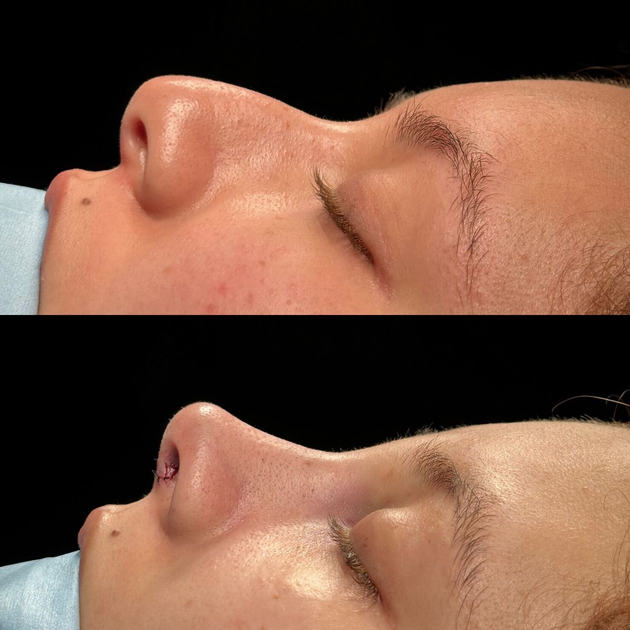 Angel Castro Urquizo-138