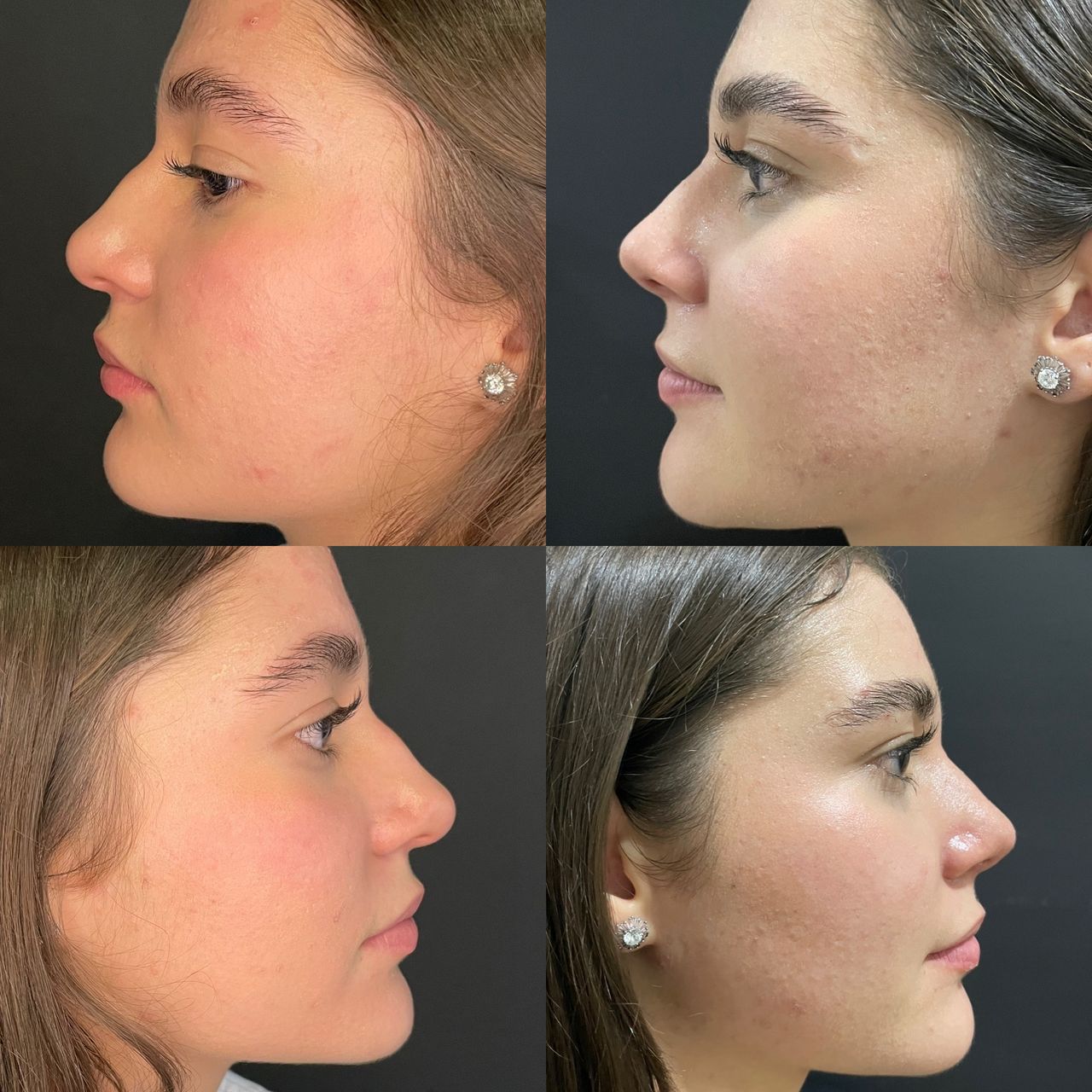 Teresita Flores Saldaña-0