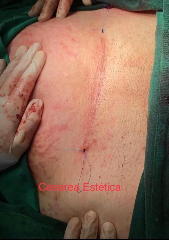 Guadalupe Muñoz Castro-71