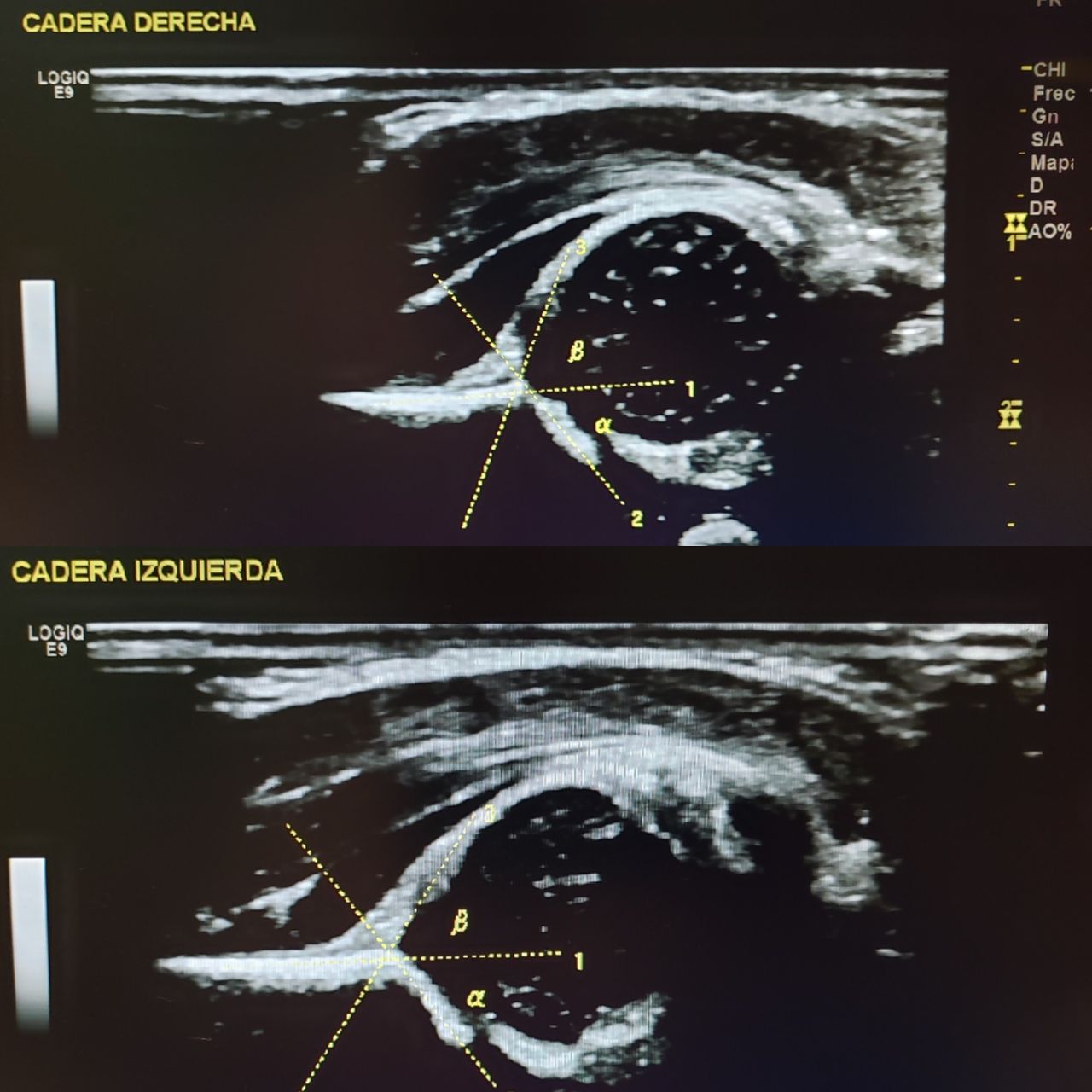 Alfonso Meza Vernis-74