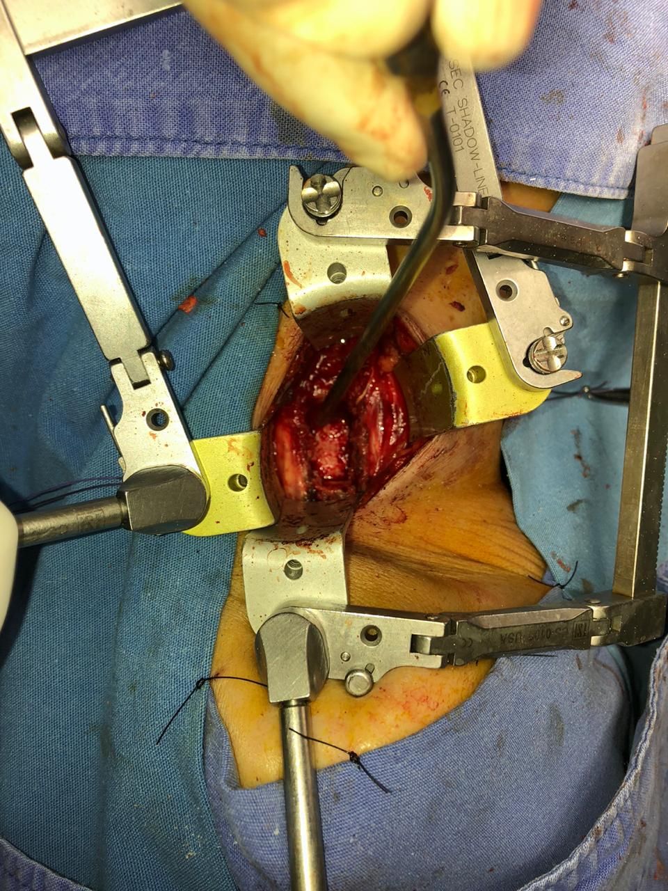 Juan José Luévano De La Cruz-7