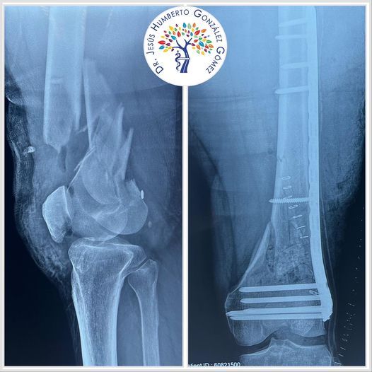 Jesús Humberto González Gómez-20