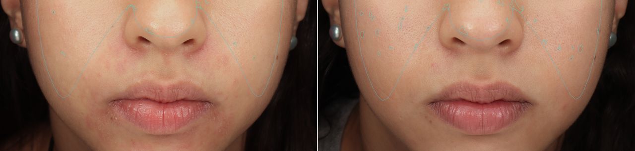 Lauro Francisco Varela Coronado-7