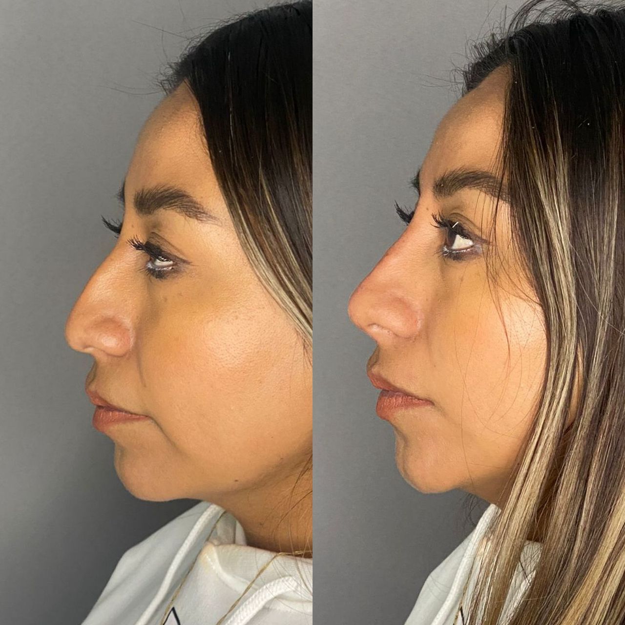 Juan Antonio Munguia Baltodano-10