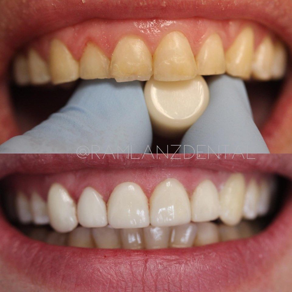 Germán Arturo Ramírez Barreto-15