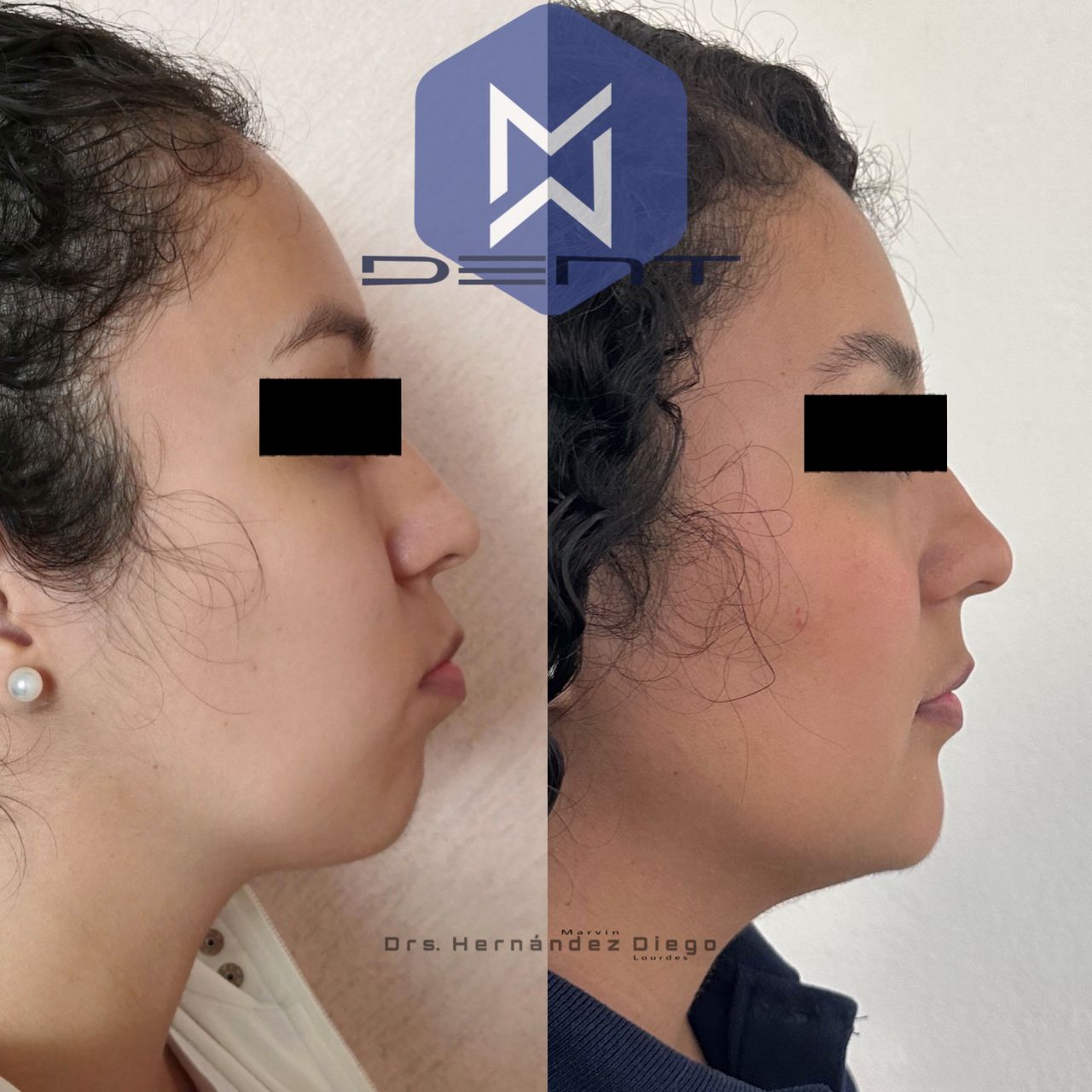 Marvin Adair Hernández Álvarez-13