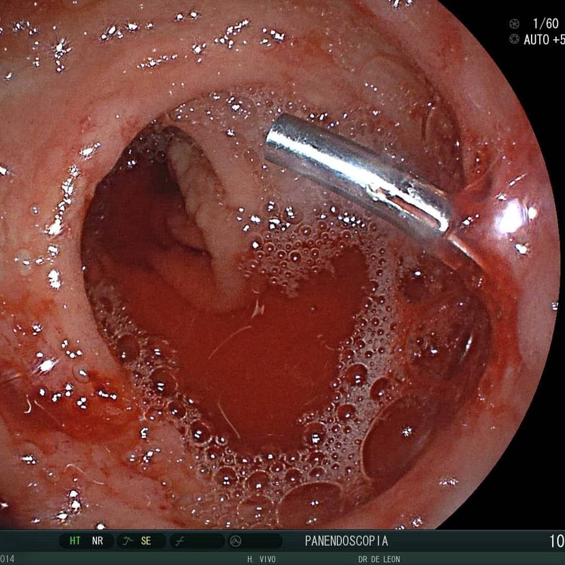 Edgar Alan De León Rojas-8