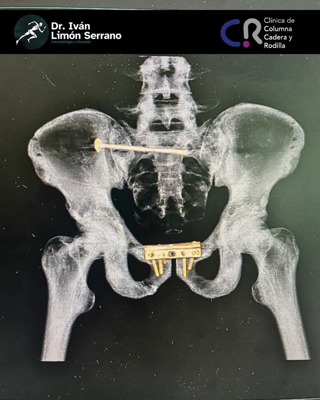 Iván Limón Serrano-23