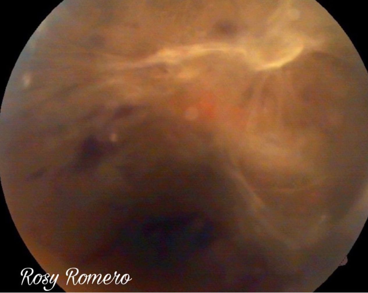 Rosa María Romero Castro-15