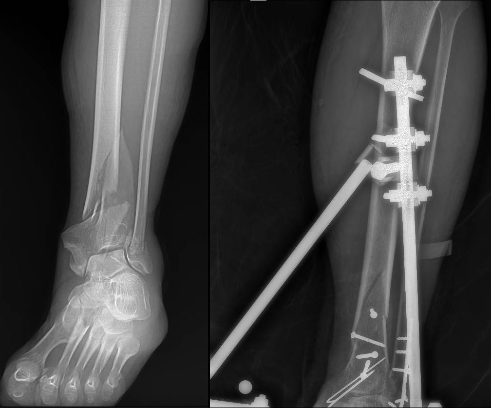 Luis Castañón Robles-22