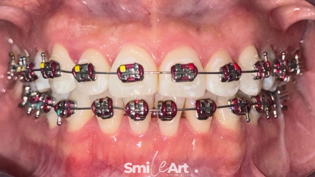 Andrea Amairani Ruiz Miranda-14