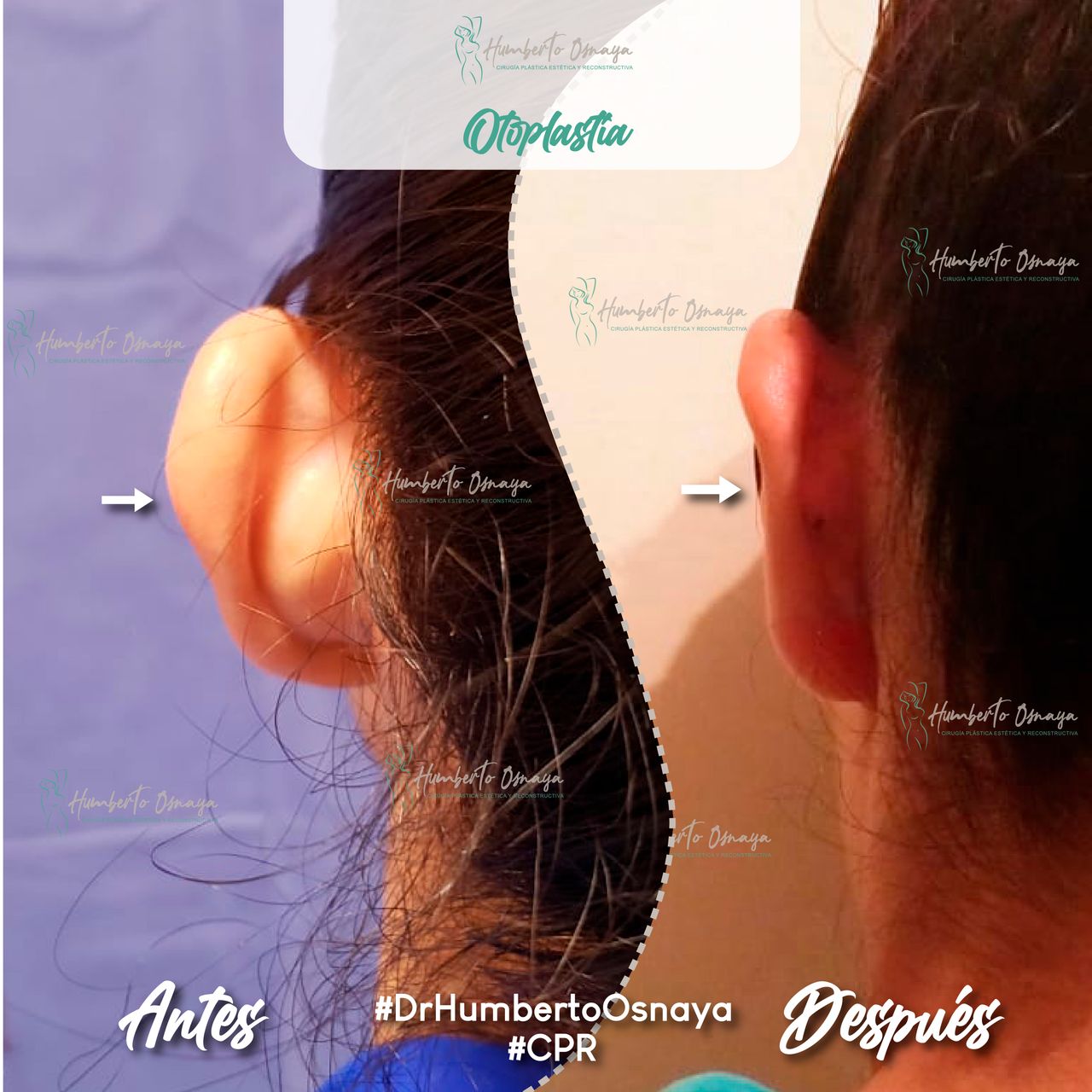 Humberto Osnaya Moreno-37