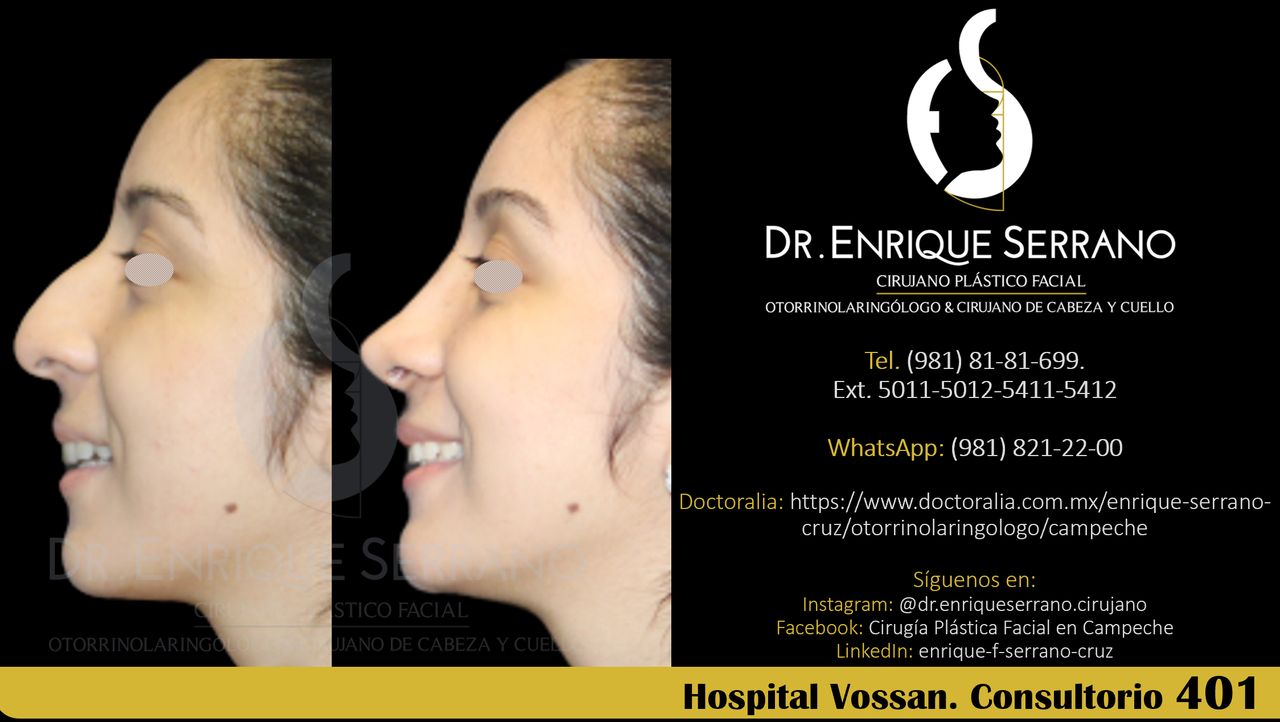 Enrique Serrano Cruz-115