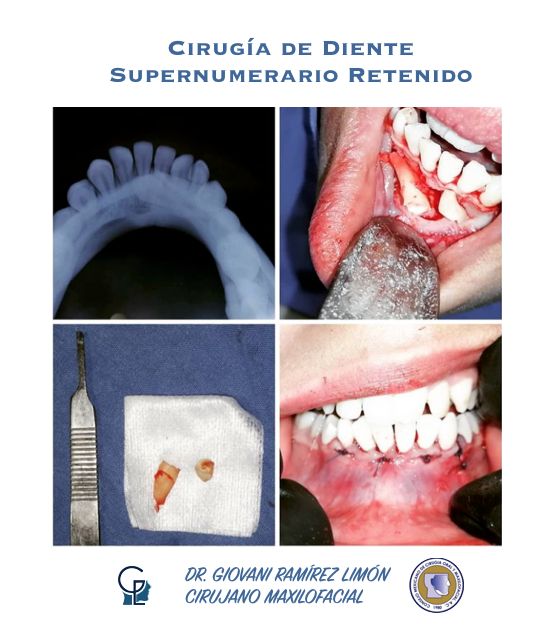 Giovani Ramírez Limón-37