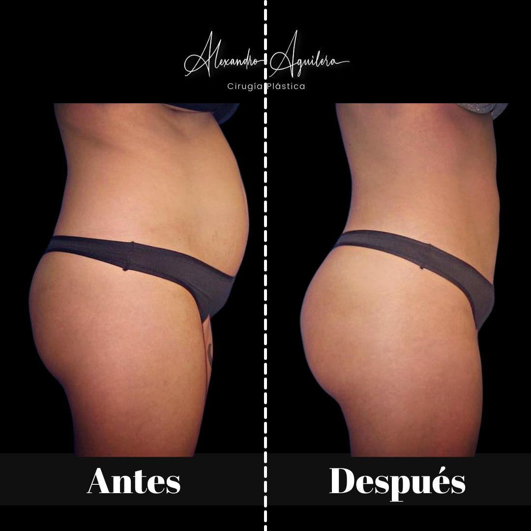 Alexandro Aguilera Salgado-7