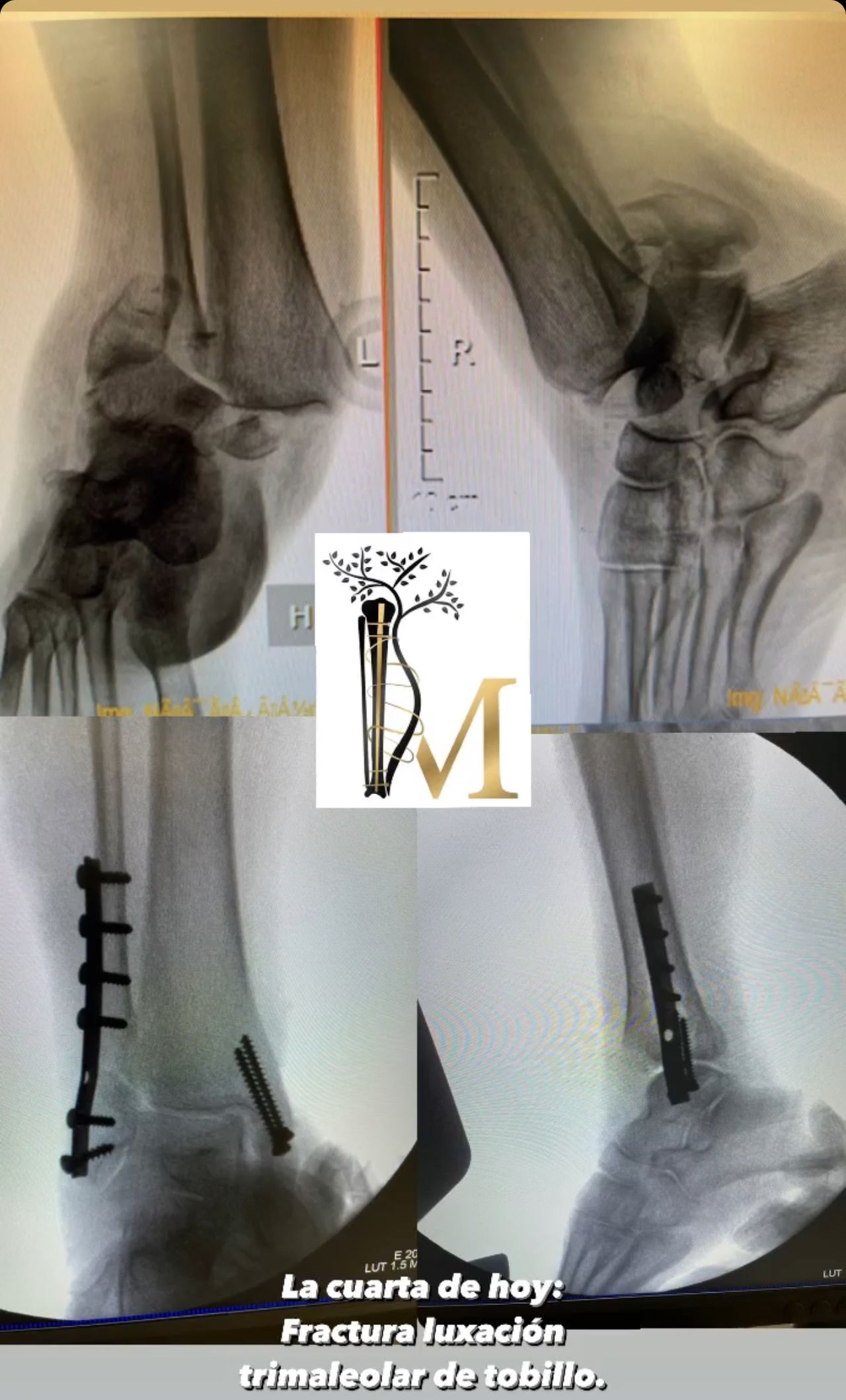Marco Polo Malacón Gutiérrez-17