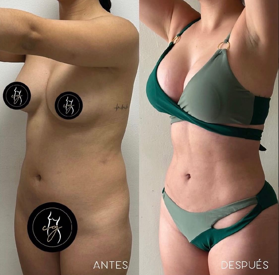 Carlos Alberto Gaitán García-3