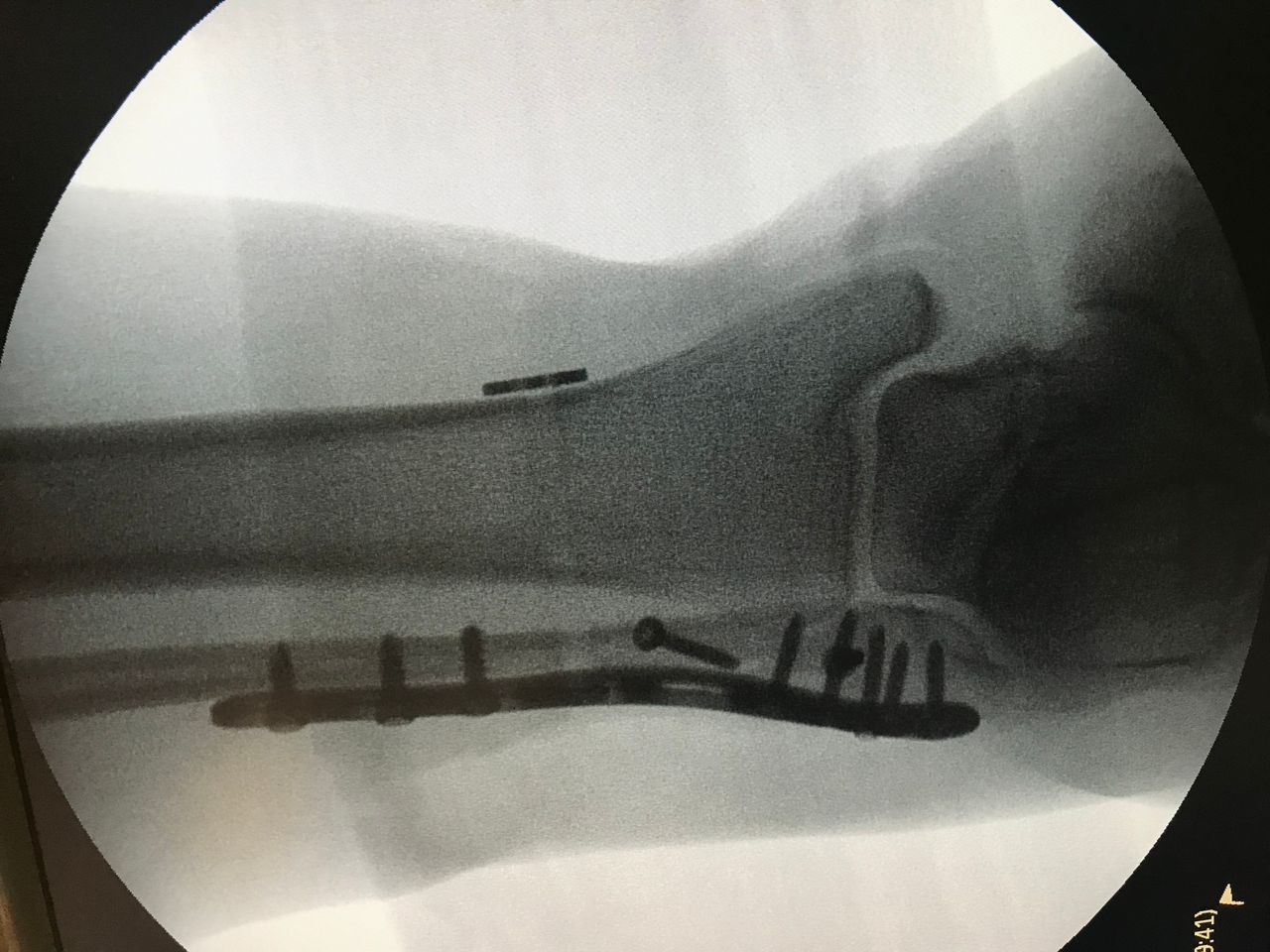 Gustavo E Ramirez Reyna-5