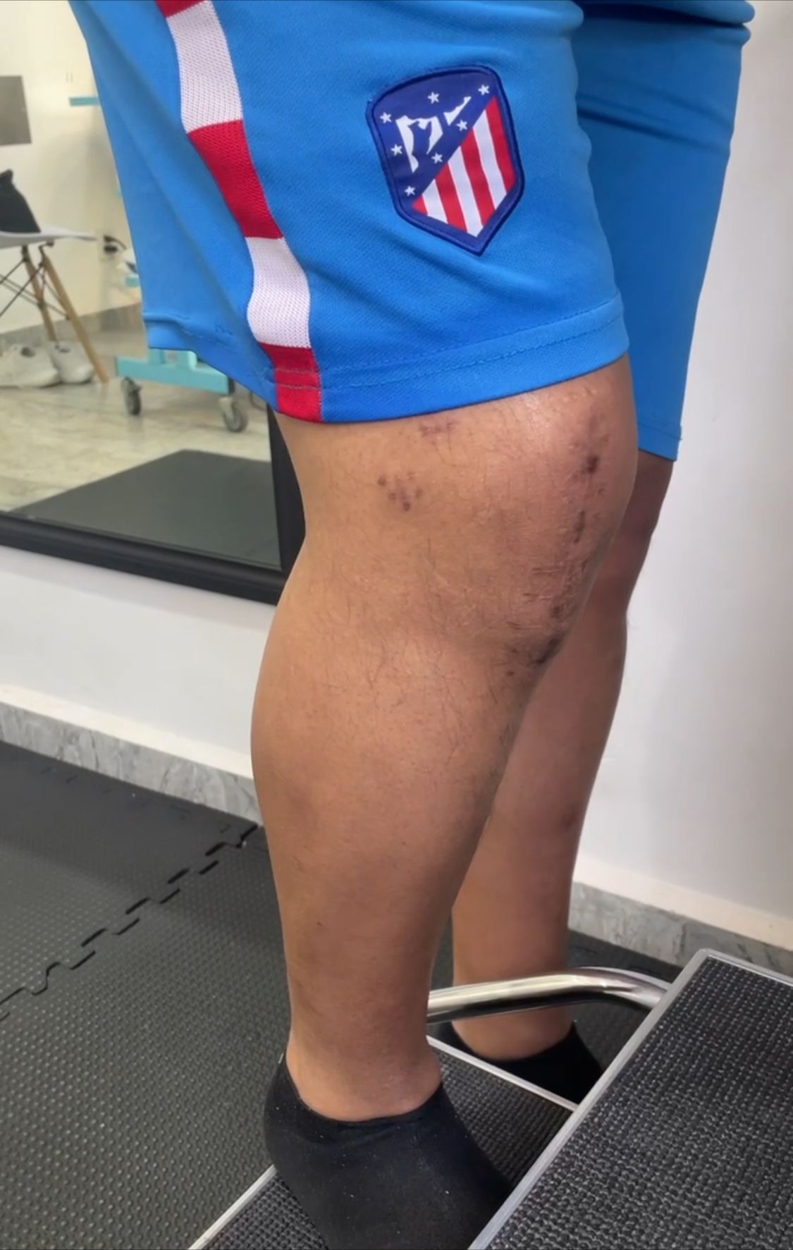 Irving Denilson Peña González-6