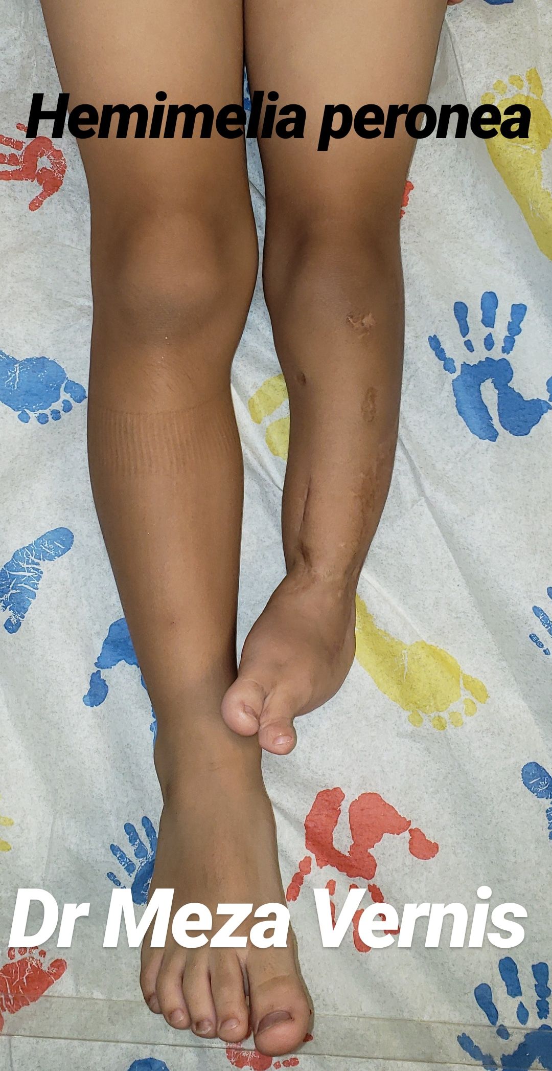 Alfonso Meza Vernis-75