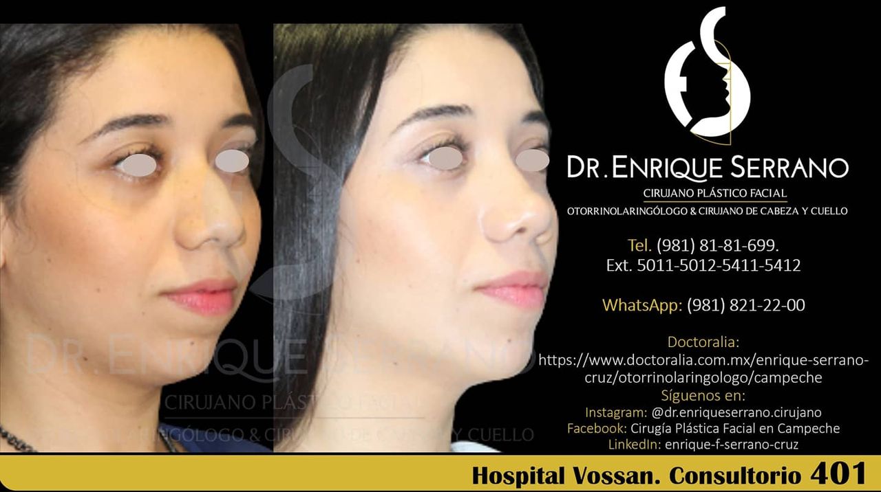 Enrique Serrano Cruz-116