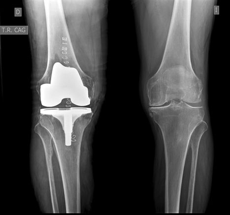 Fernando Ortiz Romero-16
