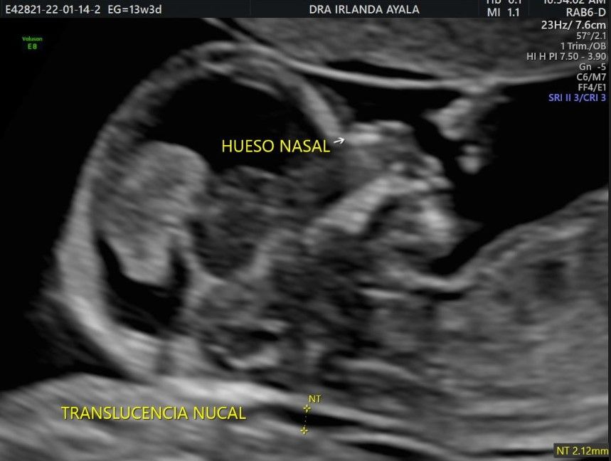 Irlanda Ayala Díaz-3