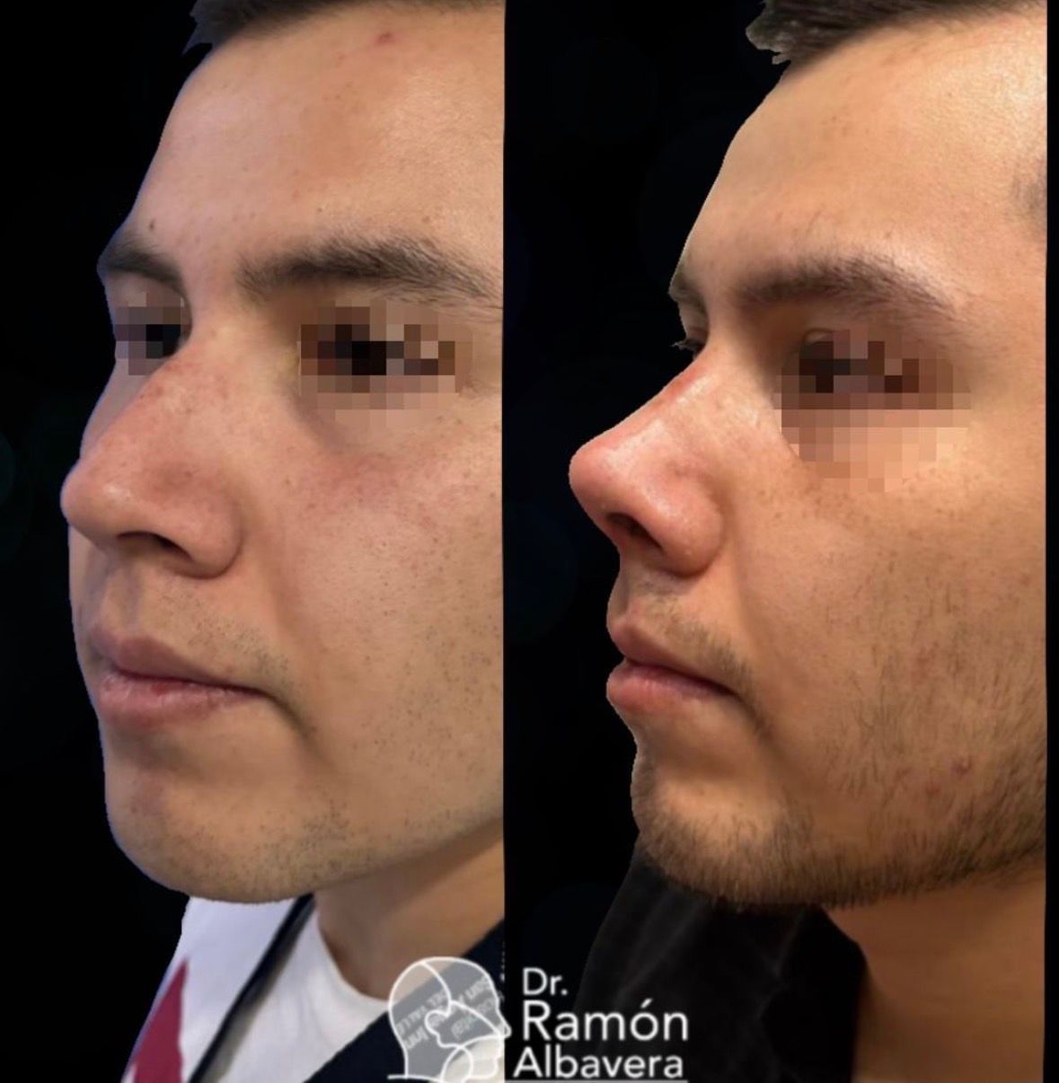 Luis Ramón Albavera Giles-1