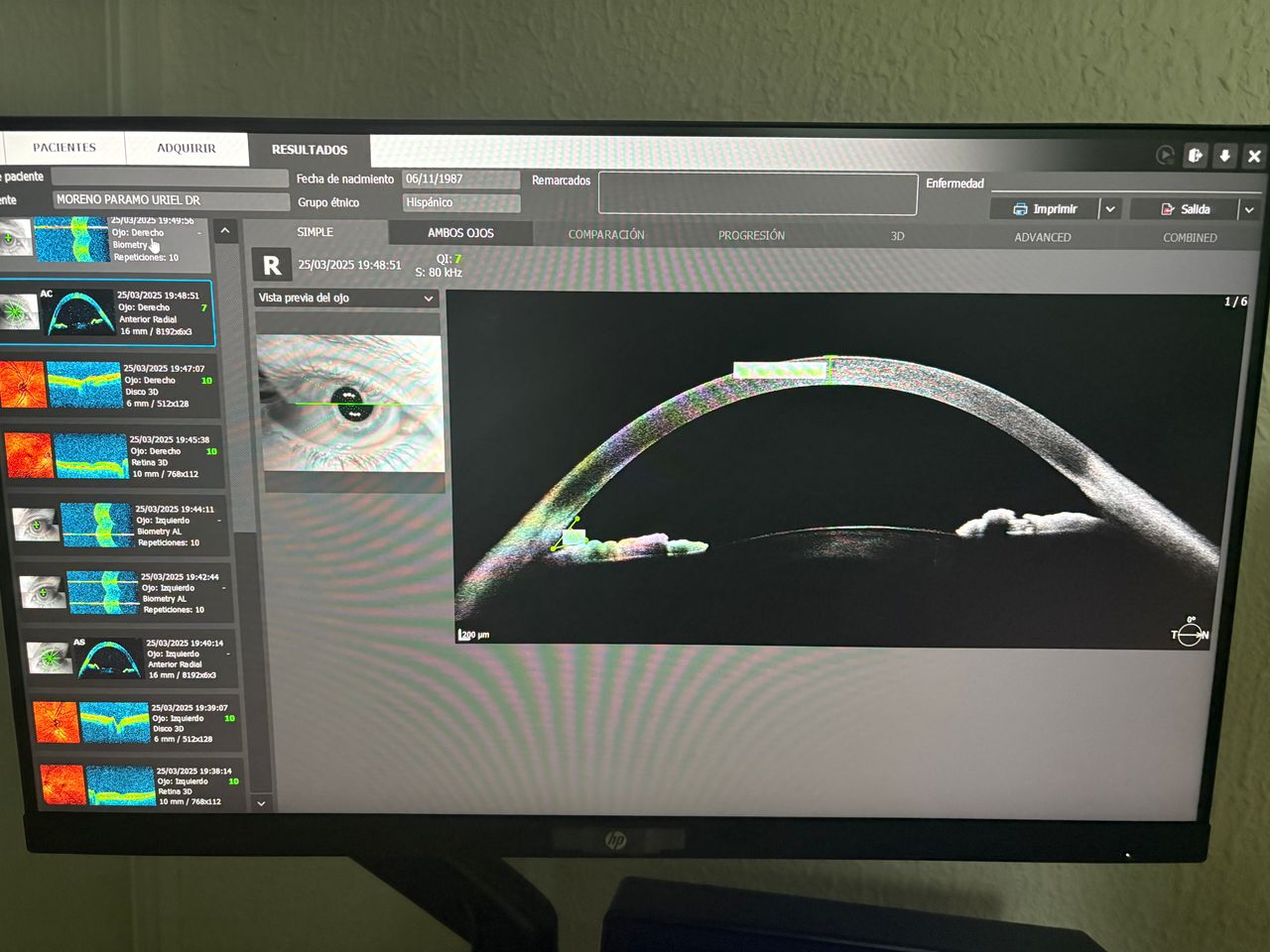 Uriel Moreno Páramo-9