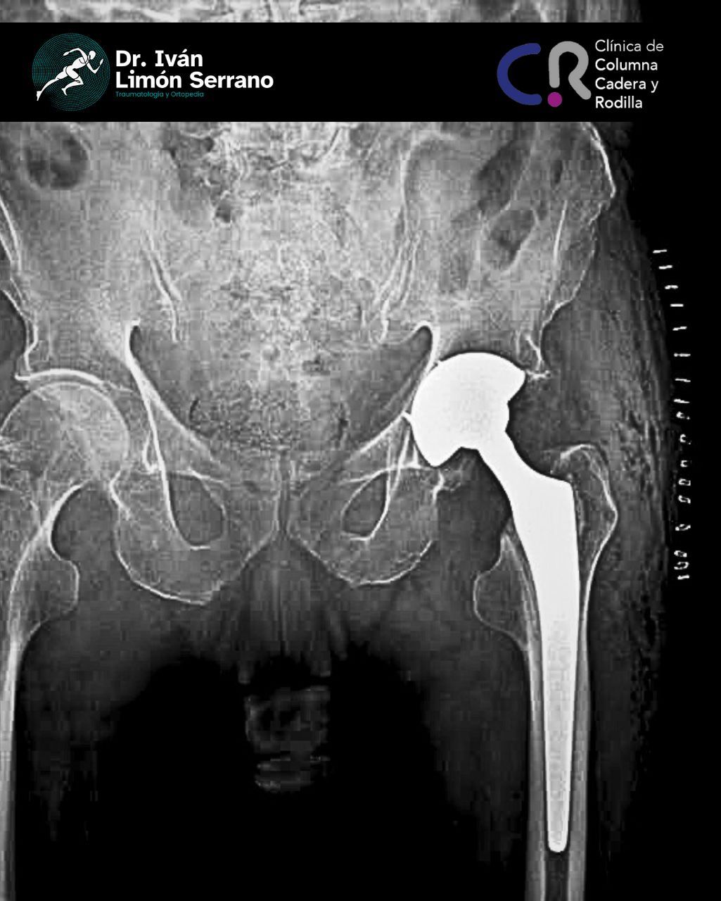 Iván Limón Serrano-34