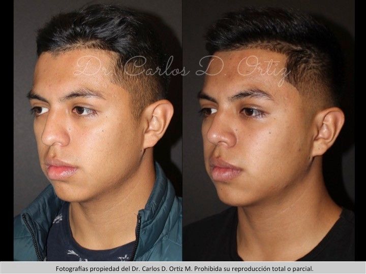 Carlos David Ortiz Moreno-36