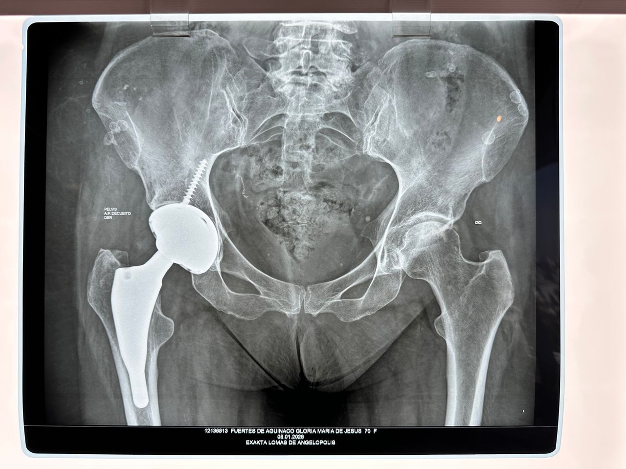 Alejandro Martínez Ramírez-36