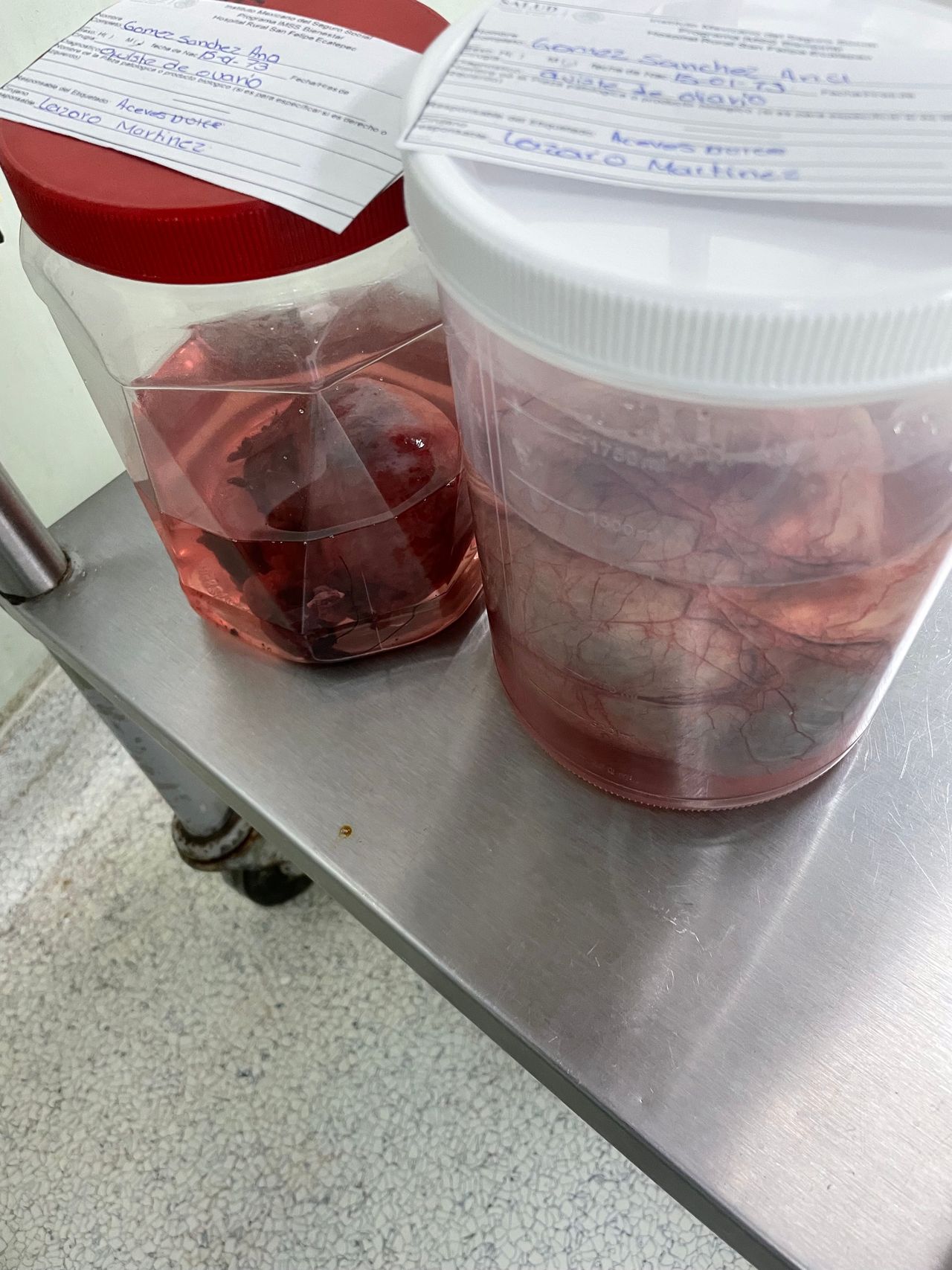 Javier Lázaro Martinez-2