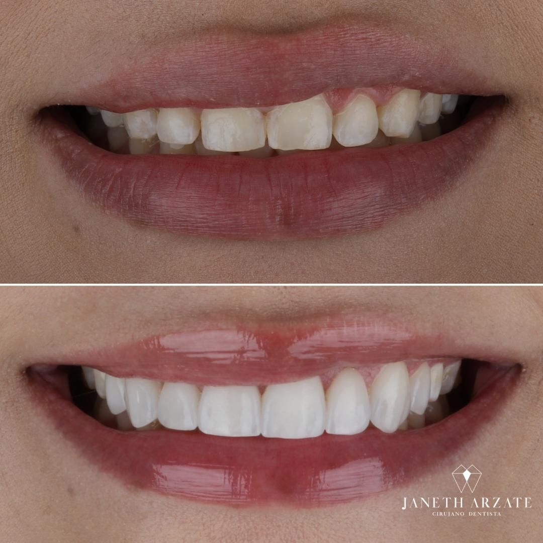 Janeth Arzate Banda-8