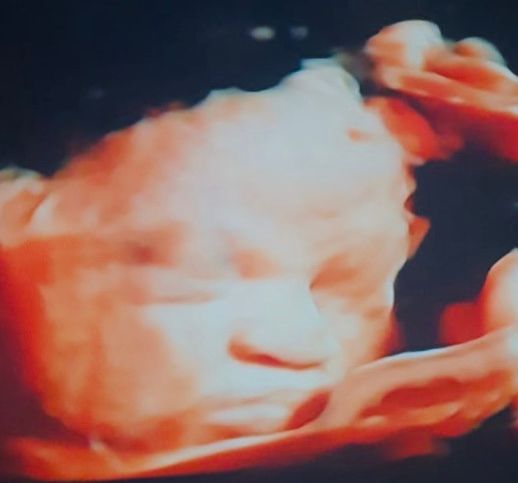 Brenda Lisset Briones Bernal-18