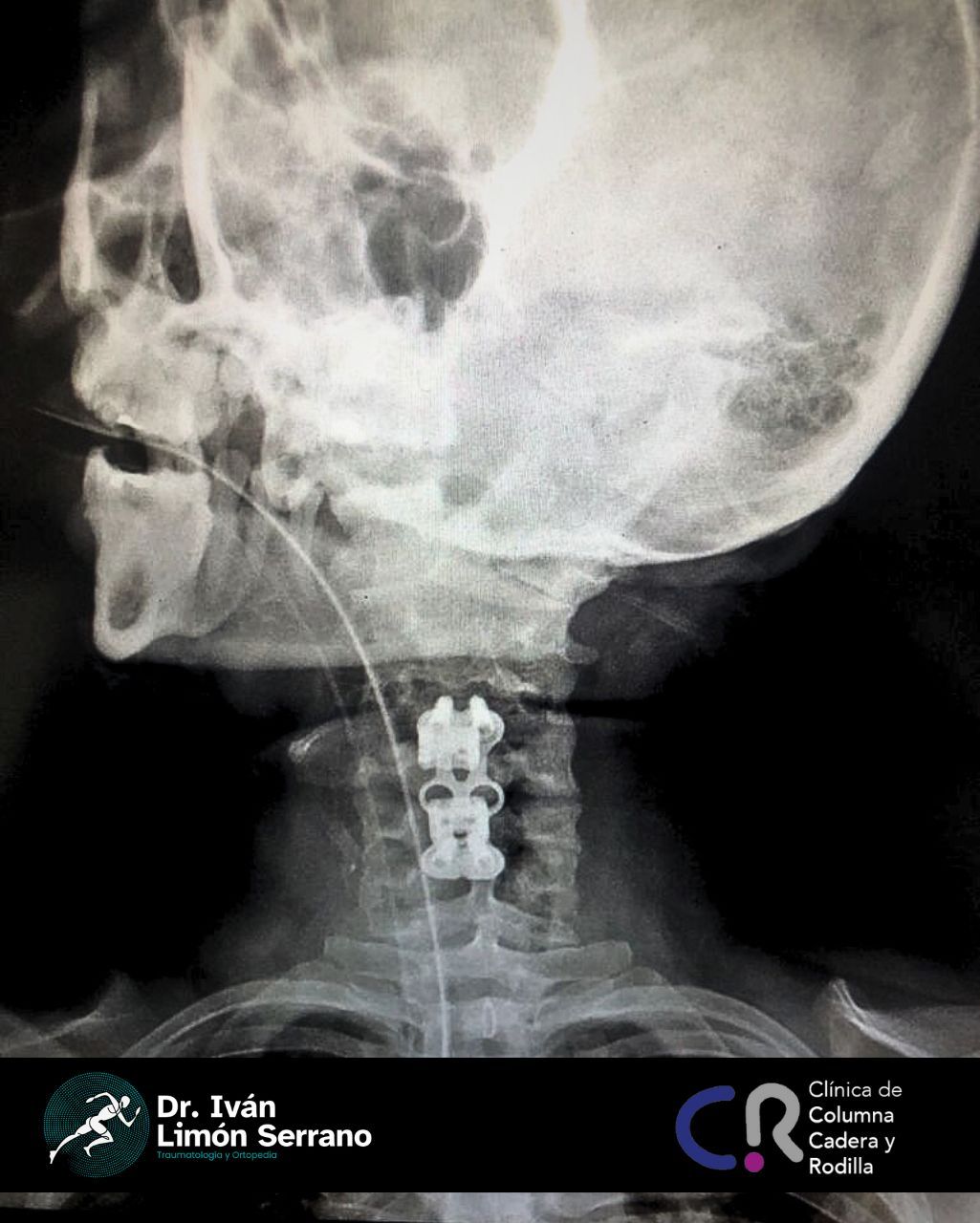 Iván Limón Serrano-24