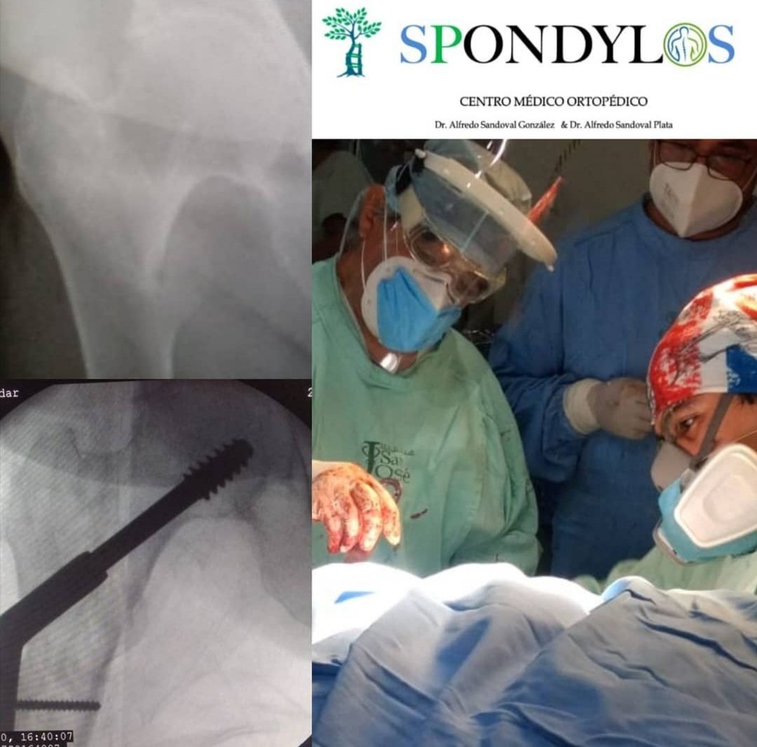 Alfredo Sandoval Plata-24